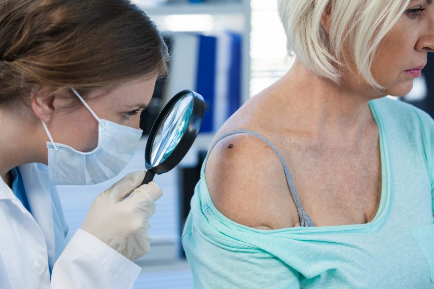 Una delle più insidiose forme di melanoma è quella del cuoio capelluto. I controlli periodici giocano un ruolo primario nella diagnosi precoce.