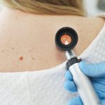 Ecco i contenuti ottimizzati per l'immagine fornita: Tag ALT: Medico dermatologo che utilizza un dermatoscopio per l'esame dei nei sulla schiena di una paziente per la prevenzione del melanoma.