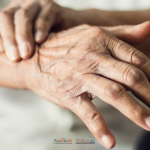 Primo piano della mano di una persona anziana sostenuta da un’altra mano, immagine sul tema del Parkinson